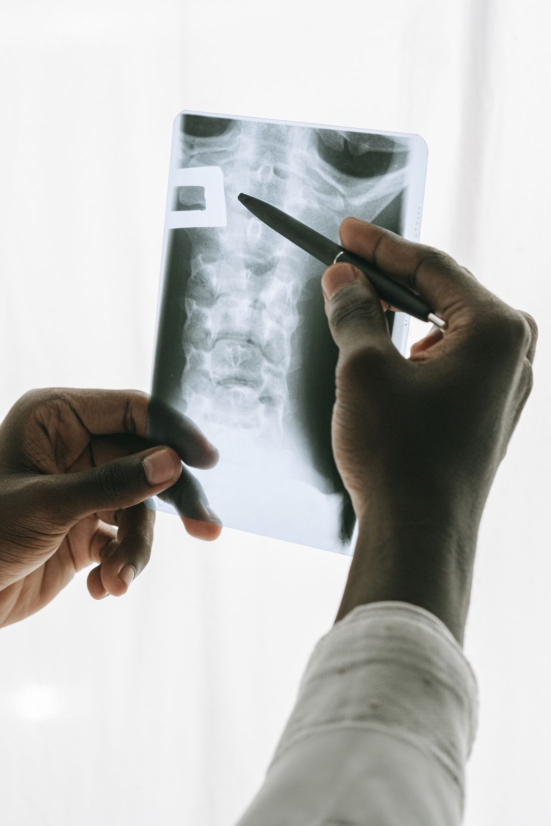 Alinhamento da postura e coluna em sessao de fisioterapia