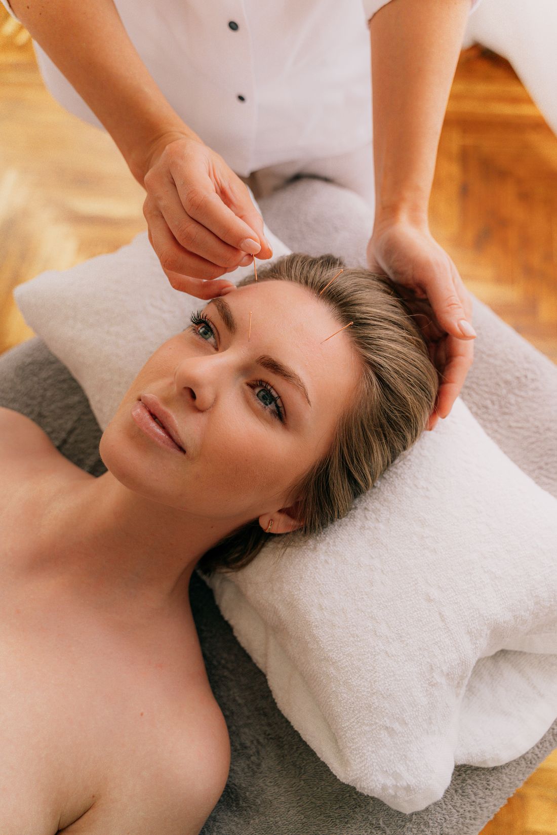 Sessao de acupuntura e relaxamento com agulhas aplicadas no rosto