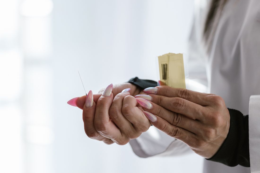 Agulhas de acupuntura aplicadas nas costas de uma pessoa durante sessão clínica